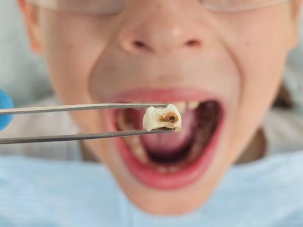 Best Emergency Orthodontic Repairs in Sherwood, WI